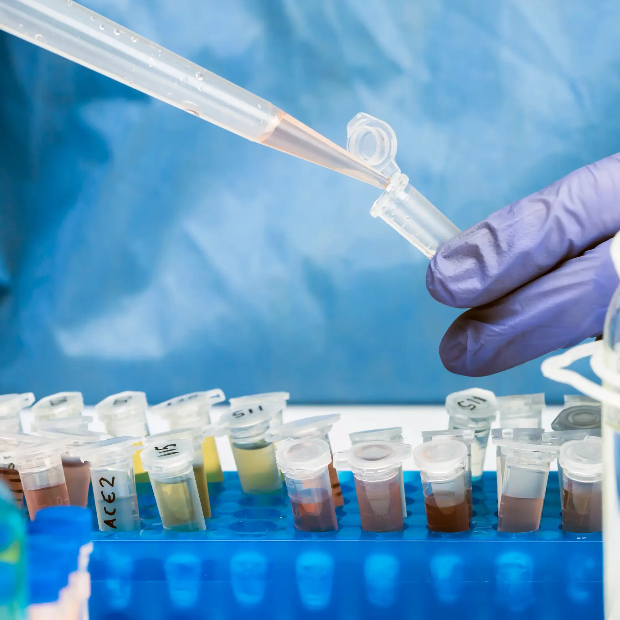 Pharmaceutical Wastewater